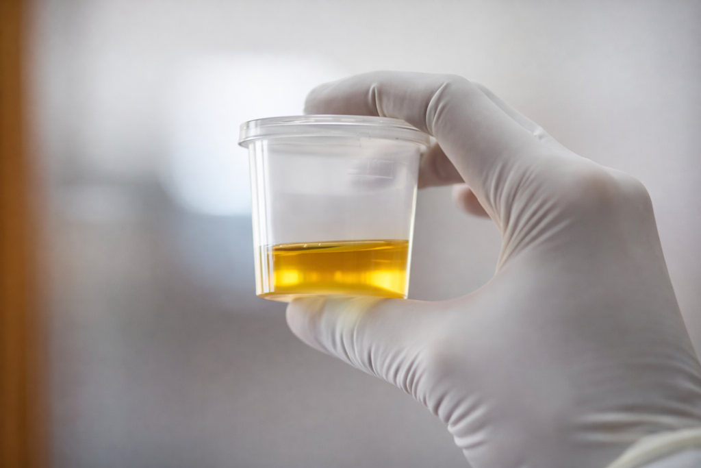 What to Do Before a Urine Test – Complete Guide for Patients