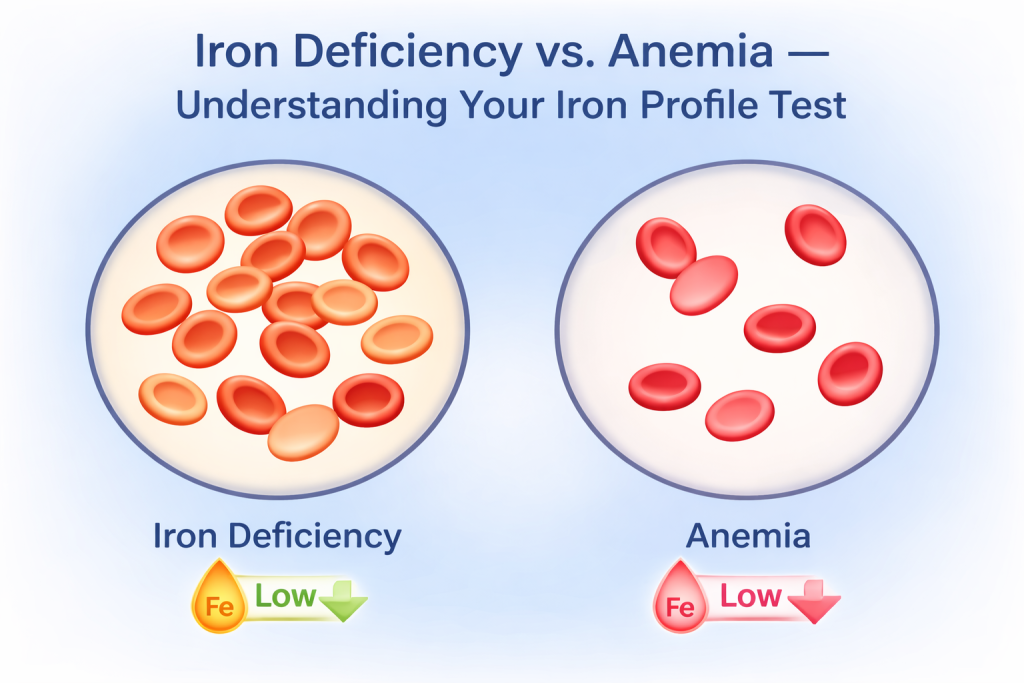 Iron Deficiency vs. Anaemia — Understanding Your Iron Profile Test