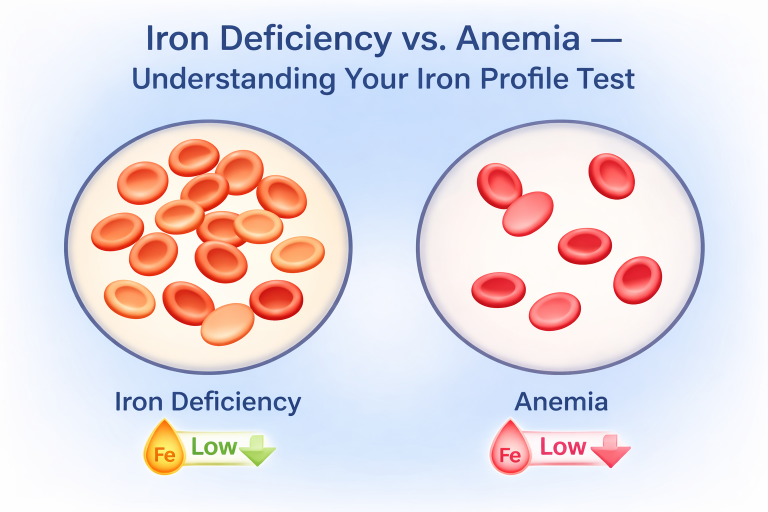 iron deficiency anaemia Archives - Lab Tests Surat | Nobel Micro Path